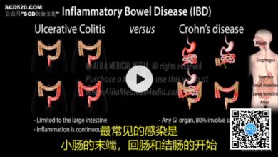 克罗恩和溃疡性结肠炎的区别的照片